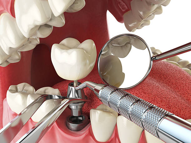 Best Walk-In Emergency Dentist in Morris Plains, NJ